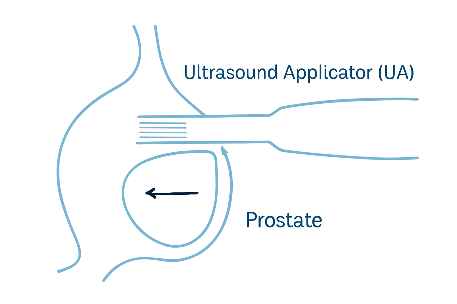 Ultrasound Applicator